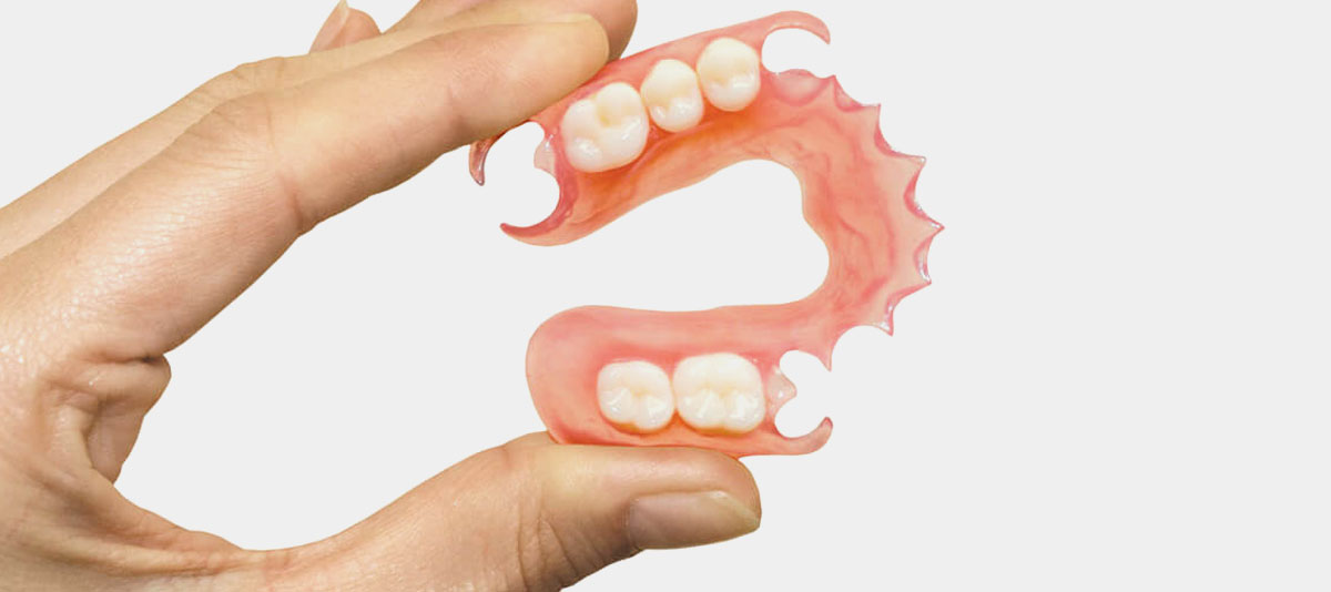 Removable Partial Dentures.