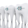 Who is an Orthodontist and what treatments do they do?